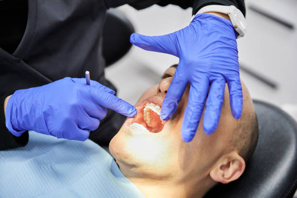 Best Emergency Root Canal Treatment in Edisto, SC